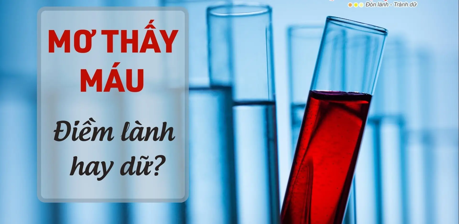 Nằm Mơ Thấy Máu Đánh Lô Con Gì - Giải Mã Những Ý Nghĩa Bí Ẩn